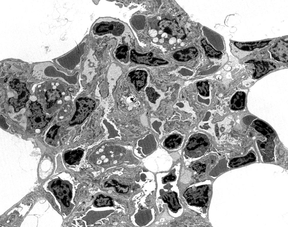 Lung tissue